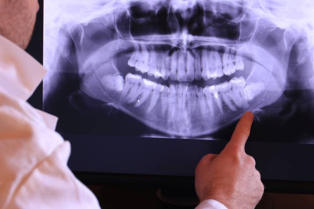 Best Emergency Gum Treatment in Marlboro Meadows, MD