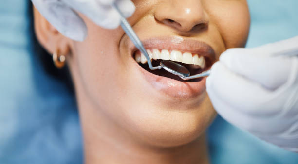 Best Emergency Treatment for Dental Infections or Abscesses in Marlboro Meadows, MD